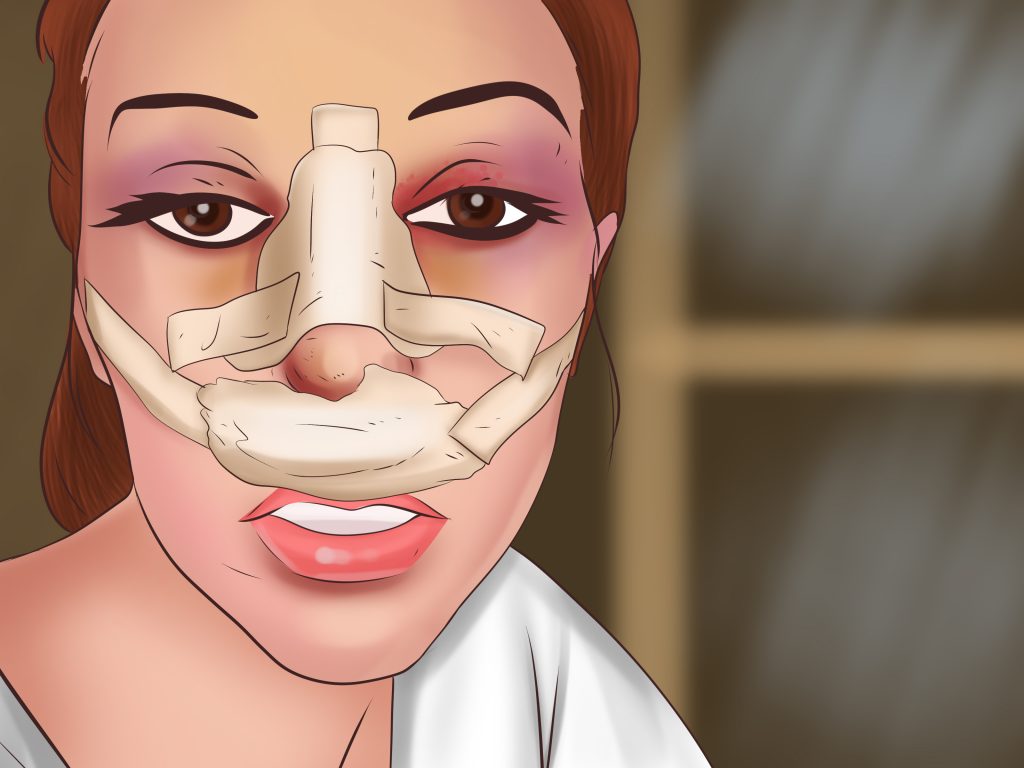 The Bakit list of why plastic surgery is frowned upon in PH The