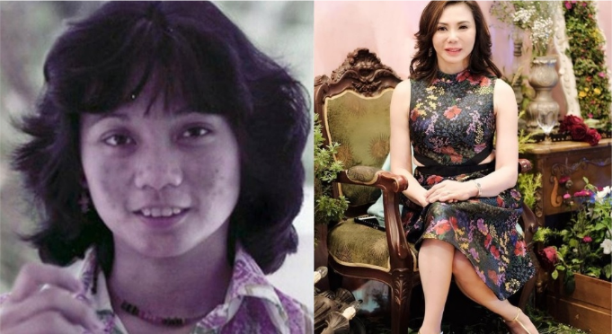 Dra. Vicki Belo before her plastic surgery empire | The ...