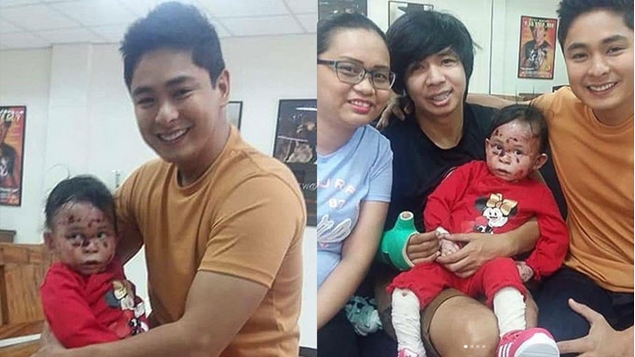 Coco Martin grants wish of fan with rare skin condition - The Filipino Times