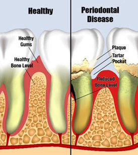 Pinay dentist in Abu Dhabi warns horrors, risks of smoking for your ...