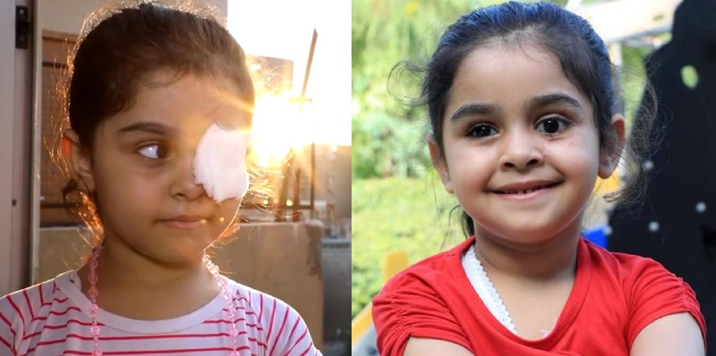 WATCH: UAE provides prosthetic eye to young victim of Beirut blast ...