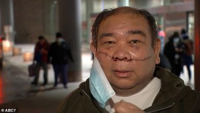 Noel Quintana New York Subway Fil-Am Slashing Incident. Photo from ABC7