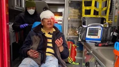 Yuchang Filipino Chinese partially blind after brutal attack in California